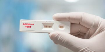 Các loại xét nghiệm Covid-19